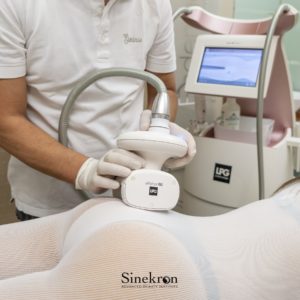 lpg endermologie avellino e benevento